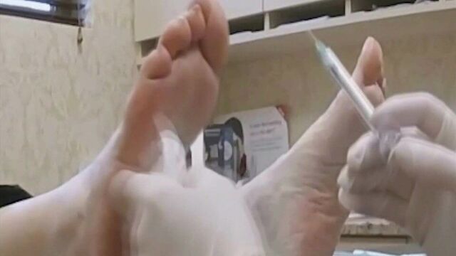 AJ Lee feet mole implant!